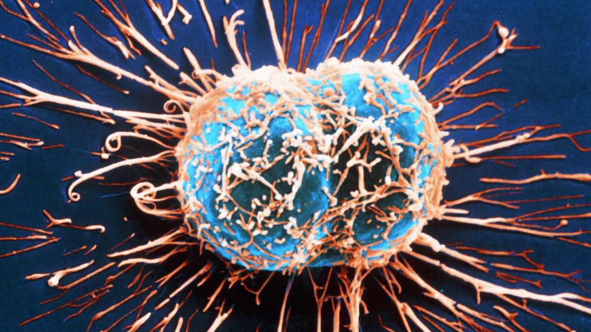Чем питаются раковые клетки в организме человека
