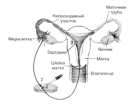 Репродуктивные органы человека