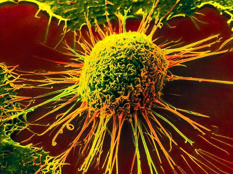Чего боятся раковые клетки: обзор источника онкологии