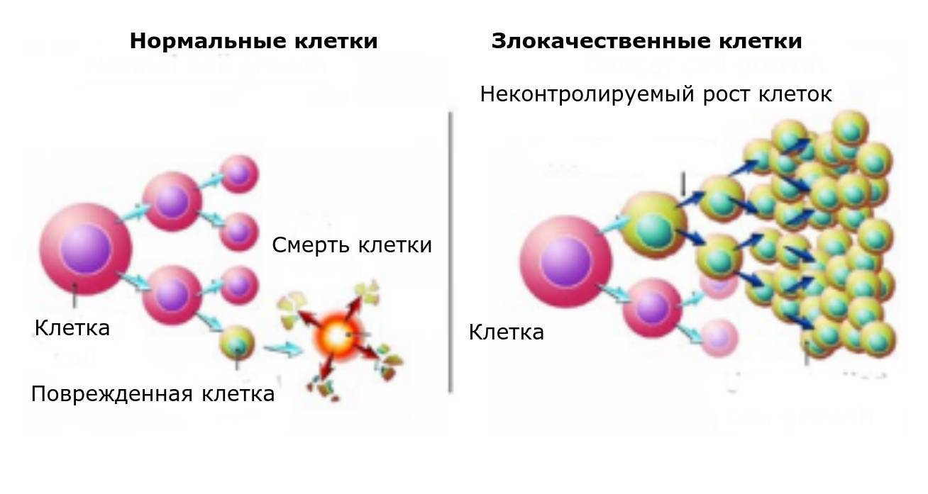 Сравнение нормальных и злокачественных клеток